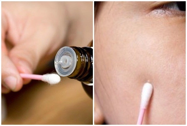 Dùng bha chống lão hoá nhưng bị bùng mụn viêm và mụn bọc là do thiếu đồ chơi đi kèm - 5