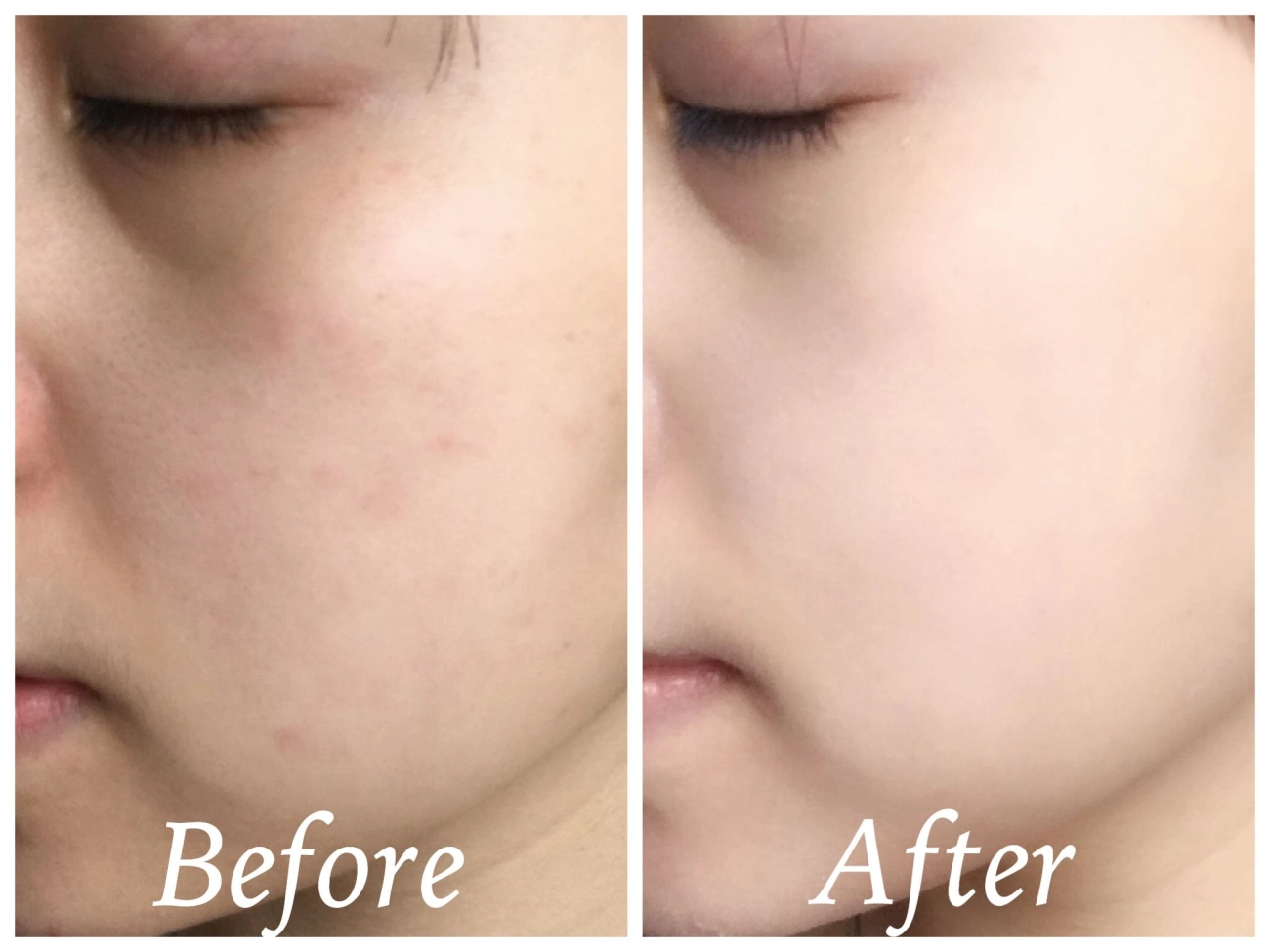 Dưỡng da bằng vitamin c bí quyết cứu vớt làn da thâm sạm già nua nhưng sự thật ra sao - 2