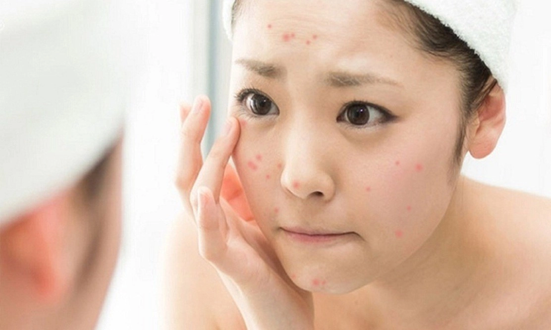 Dưỡng da cho bà bầu với nguyên liệu tự nhiên an toàn hiệu quả mà chẳng tốn mấy đồng - 4