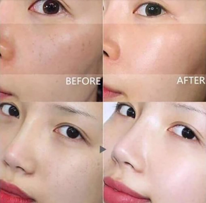 Duy trì 4 bước skincare sau trong 8 ngày da sạm nám cũng bật tone trắng sáng căng bóng - 6