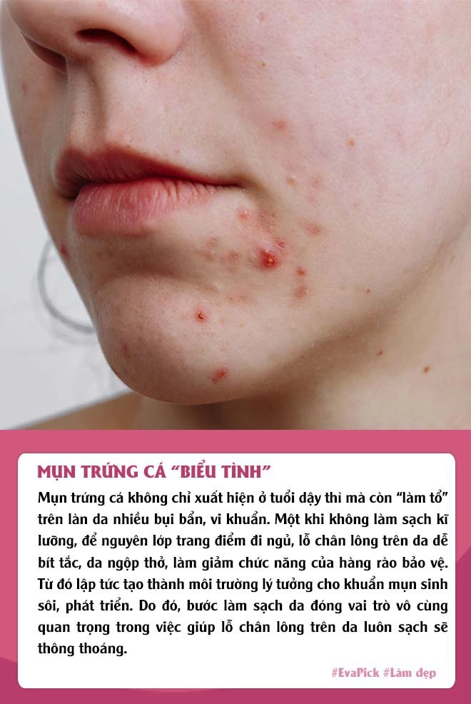 Eva pickbỏ qua 2 bước skincare trước khi ngủ chị emnhận về 6 cái hại cho làn da - 1