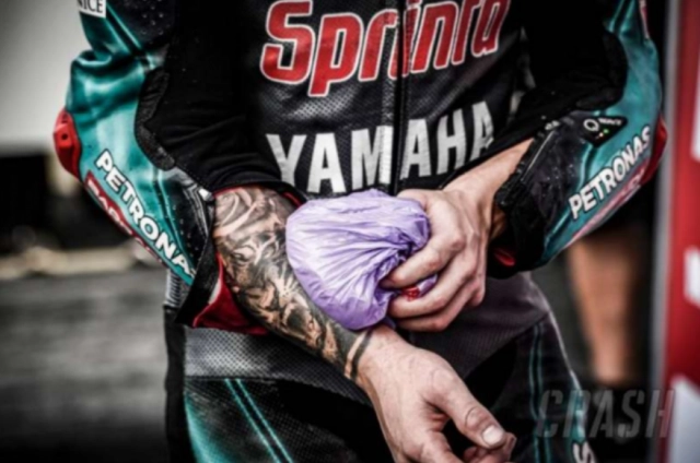 Fabio quartararo trải qua phẫu thuật tay phải trước cuộc đua motogp tại quê nhà le mans - 4