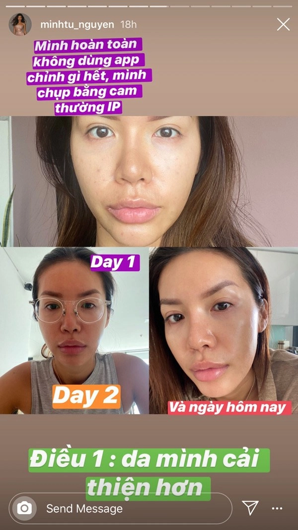 Fan hỏi chuyện tiêm botox khắp mặt nên nhìn không có nếp nhăn minh tú đáp trả hài hước - 16