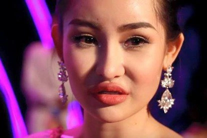 Filler tan biến nàng hậu lên đời nhan sắc thấy rõ đâu phải cứ tiêm vào là đẹp - 3