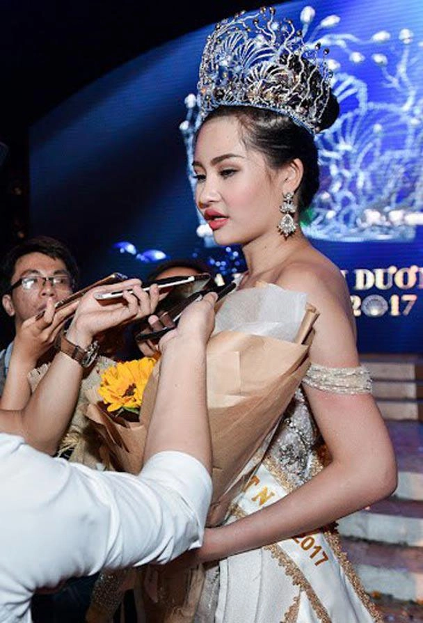 Filler tan biến nàng hậu lên đời nhan sắc thấy rõ đâu phải cứ tiêm vào là đẹp - 5