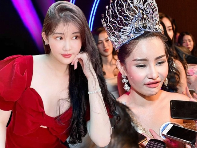 Từ da ngăm mũi tẹt nàng hậu mạnh dạn thừa nhận đẹp lên nhờ thẩm mỹ - 32