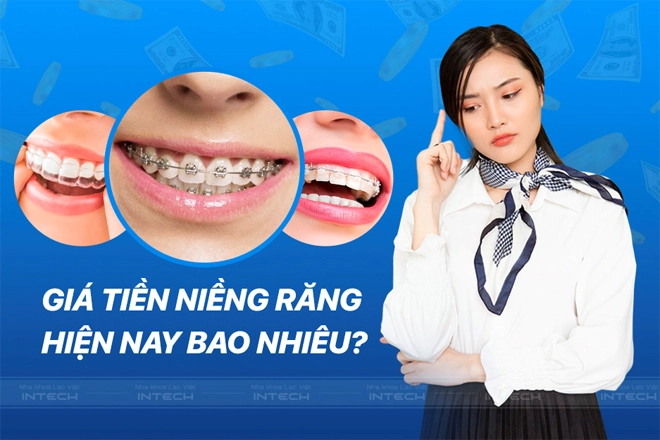 Giá niềng năng hiện nay bao nhiêu và được tính như thế nào - 1