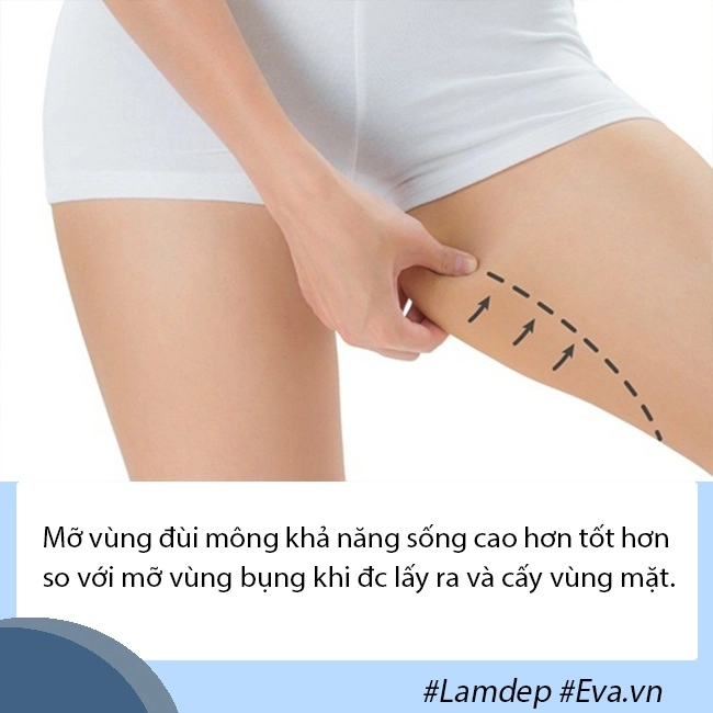 Giải đáp thắc mắc về cấy mỡ tự thân lấy mỡ vùng nào giữ lâu nhất filler liệu có cửa - 5