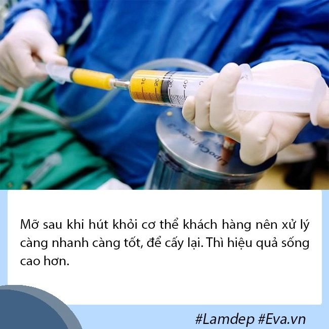 Giải đáp thắc mắc về cấy mỡ tự thân lấy mỡ vùng nào giữ lâu nhất filler liệu có cửa - 6