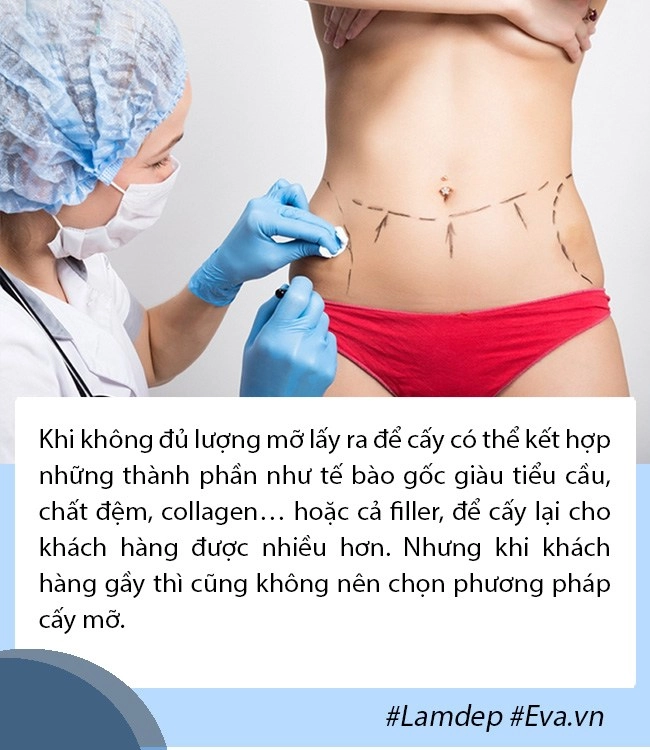 Giải đáp thắc mắc về cấy mỡ tự thân lấy mỡ vùng nào giữ lâu nhất filler liệu có cửa - 7