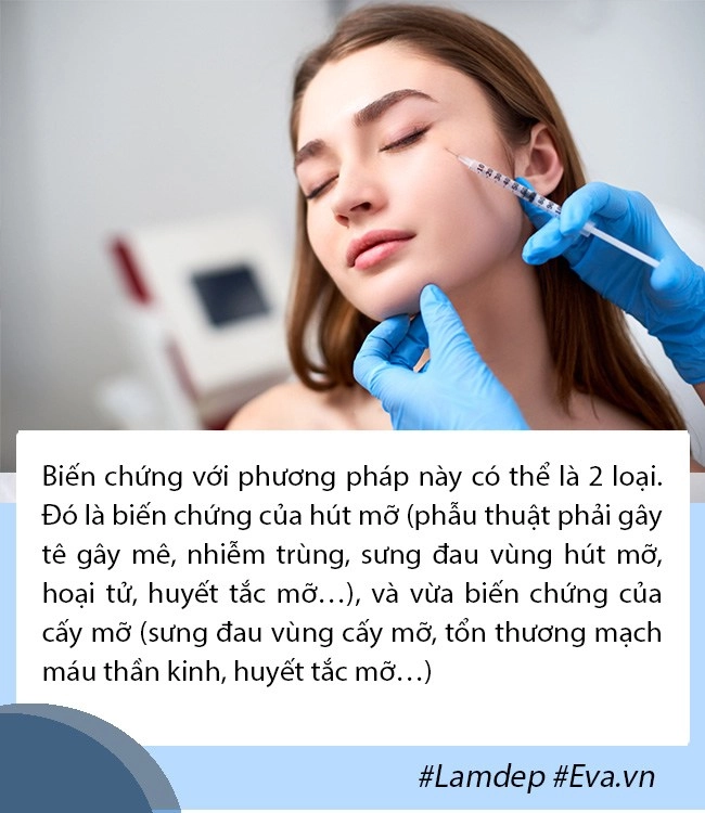 Giải đáp thắc mắc về cấy mỡ tự thân lấy mỡ vùng nào giữ lâu nhất filler liệu có cửa - 8
