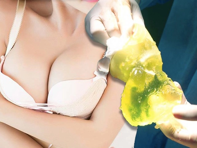 Hành trình làm đẹp 5 năm xót ví của mẹ 2 con thủng mũi áp-xe má đau nhất chữa nám - 14