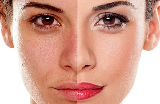 Giải mã pharmaform skin brightener - serum trắng da giảm thâm nám chỉ sau 4 tuần - 1