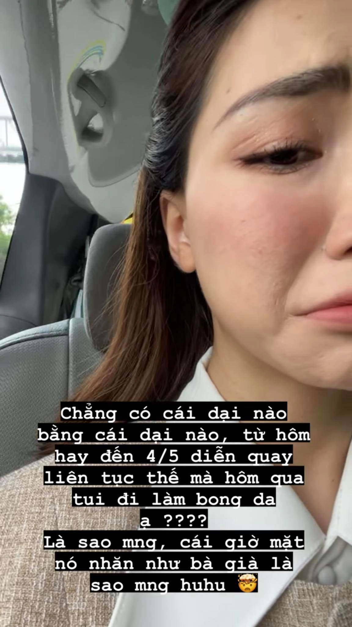 Hà hồ tự làm chuột bạch thử nghiệm mỹ phẩm da bong tróc hỏng luôn mặt tiền - 6