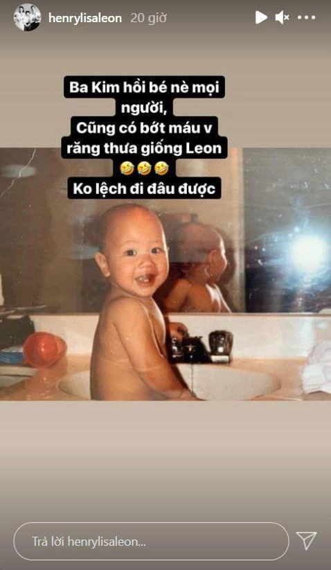 Hà hồtung ảnh kim lý lúc nhỏ chứng tỏ leon lớn sẽ thành nam thần như bố vì 2 điểm - 1