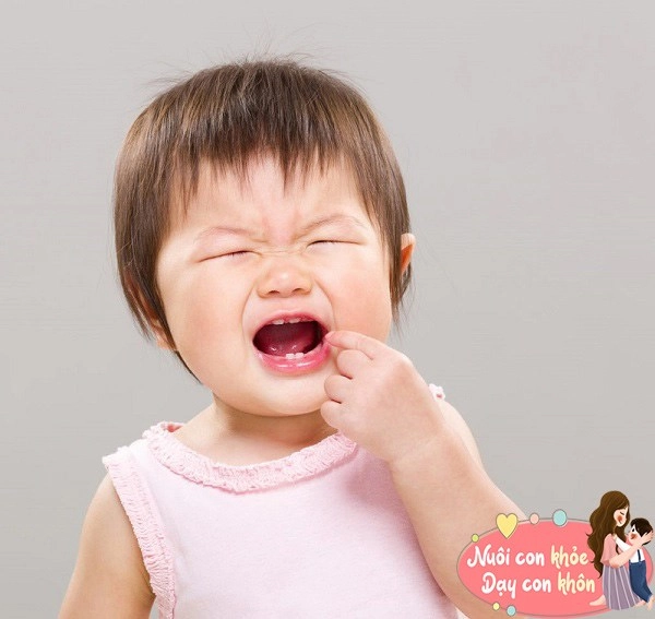 Hai thủ phạm làm hỏng hàm răng trẻ hơn cả đường không phải mẹ nào cũng biết - 3