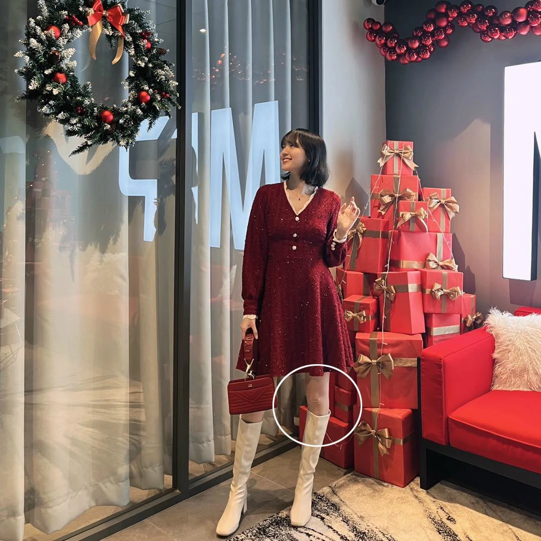 Hải tú đi chơi noel dân tình mải soi dấu hiệu sinh nở nhưng đầu gối mới đáng bận tâm - 7