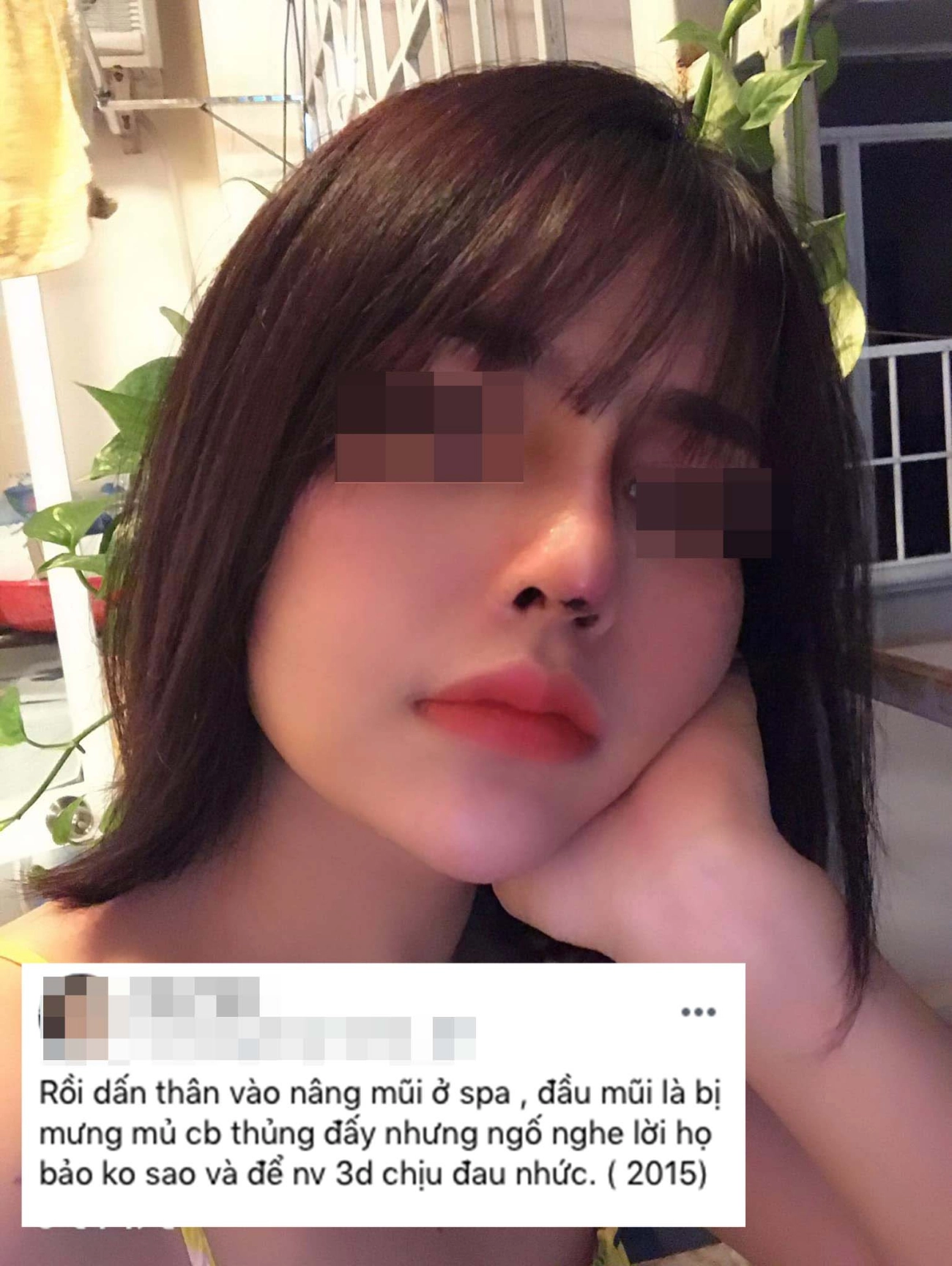 Hành trình làm đẹp 5 năm xót ví của mẹ 2 con thủng mũi áp-xe má đau nhất chữa nám - 3