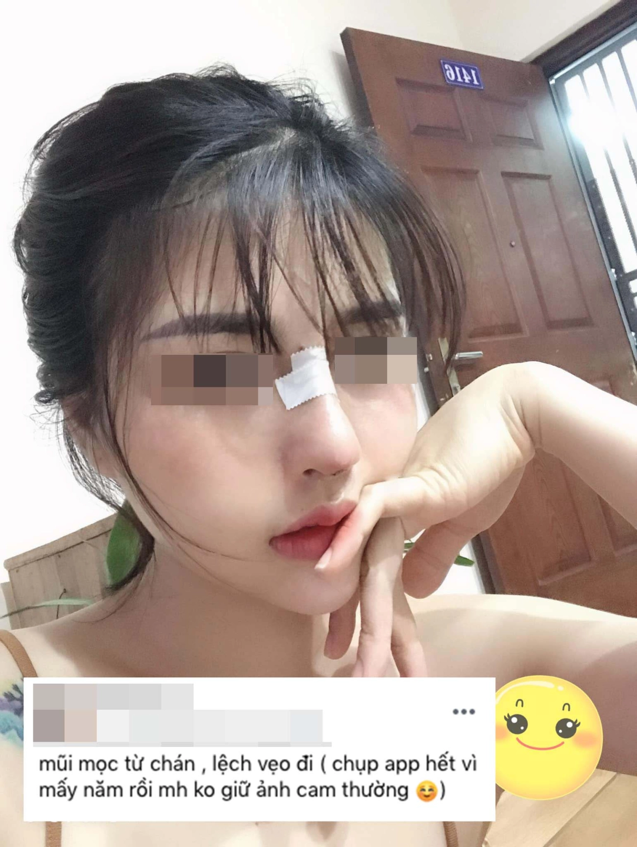 Hành trình làm đẹp 5 năm xót ví của mẹ 2 con thủng mũi áp-xe má đau nhất chữa nám - 4