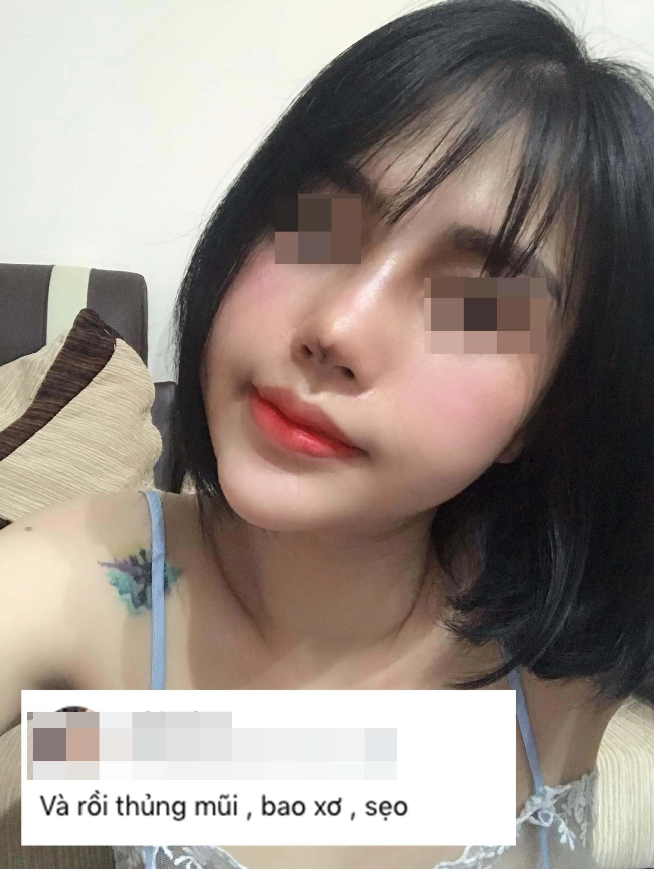 Hành trình làm đẹp 5 năm xót ví của mẹ 2 con thủng mũi áp-xe má đau nhất chữa nám - 5