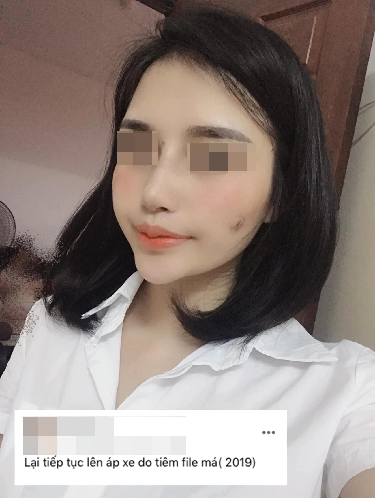 Hành trình làm đẹp 5 năm xót ví của mẹ 2 con thủng mũi áp-xe má đau nhất chữa nám - 6