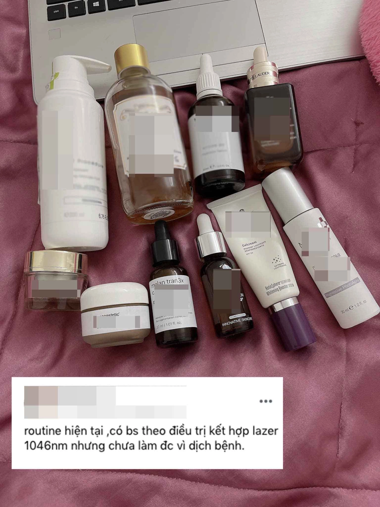 Hành trình làm đẹp 5 năm xót ví của mẹ 2 con thủng mũi áp-xe má đau nhất chữa nám - 9