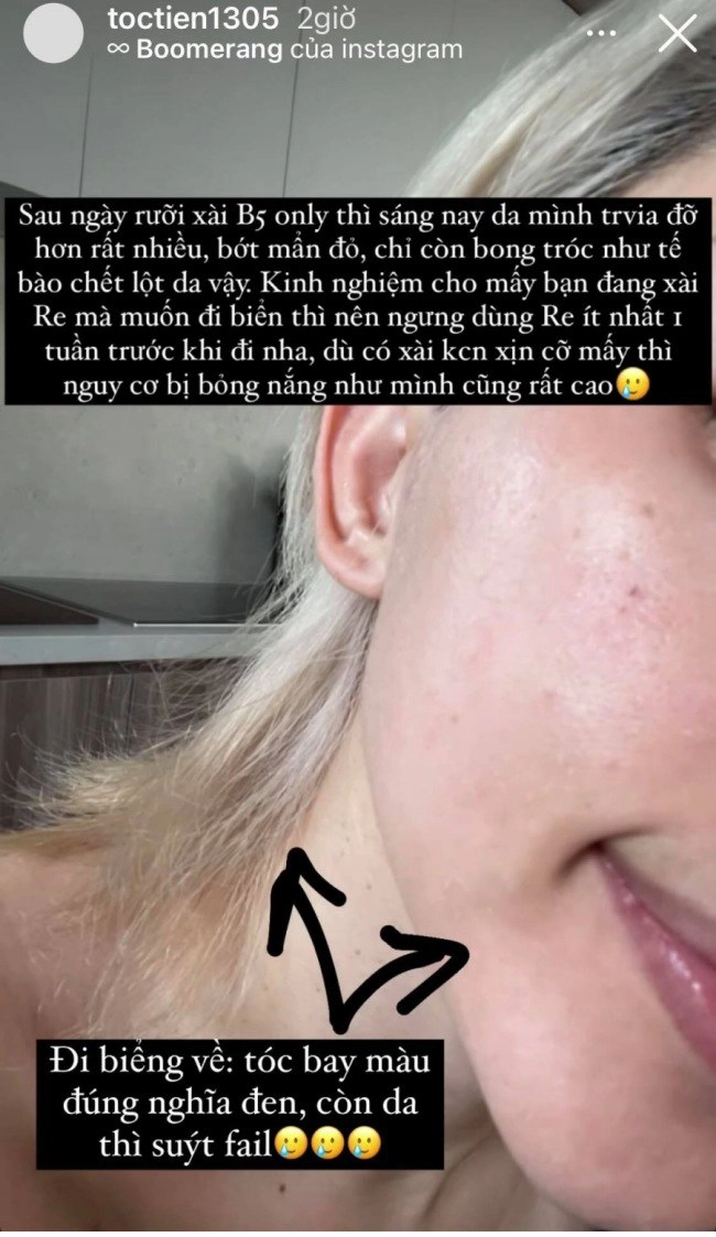 Hậu đi biển nên chăm da thế nào để trắng mịn lại hãy học minh hằng và tóc tiên - 7