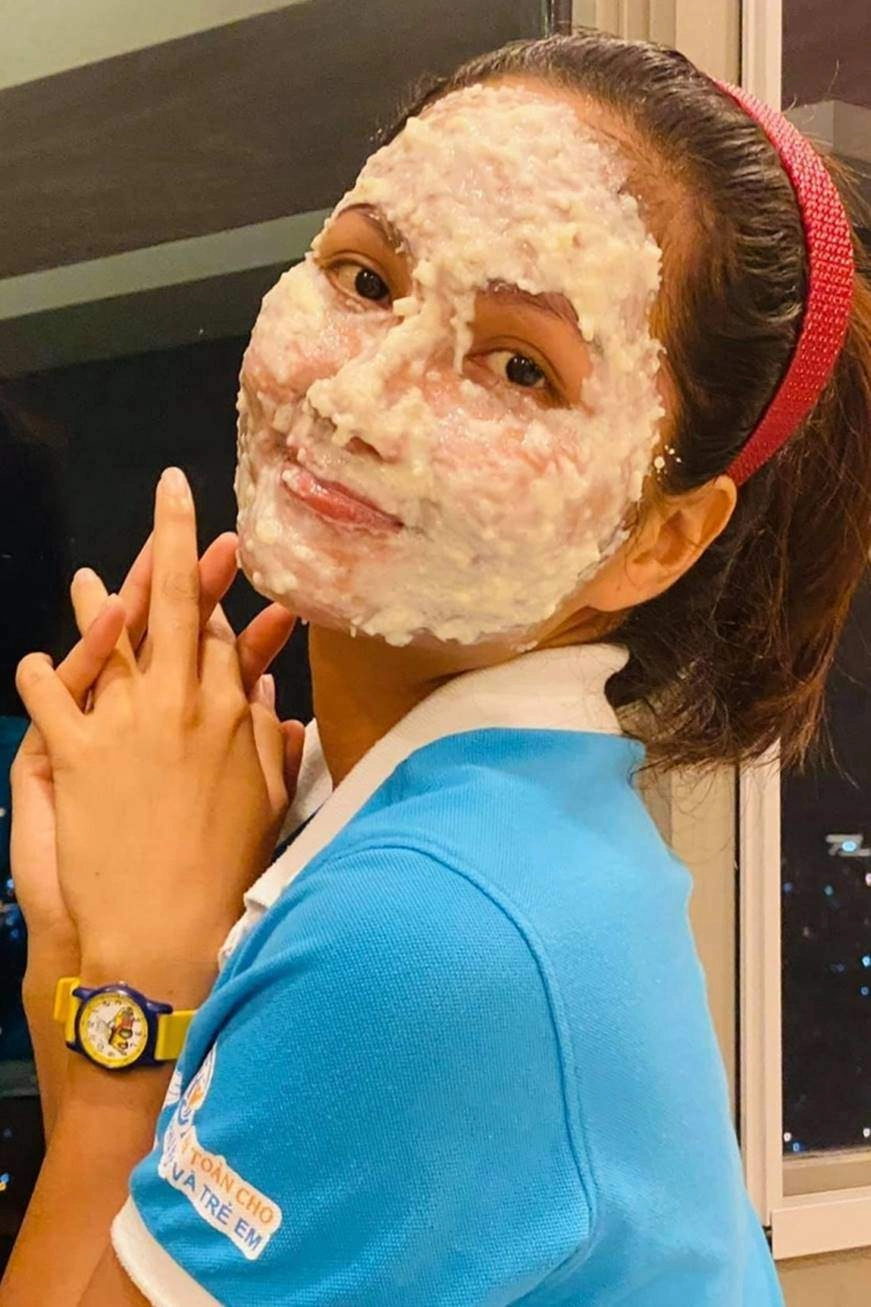 Hhen niê xuất hiện với gương mặt bầm dập skincare kiểu gì mà hỏng luôn mặt tiền - 1