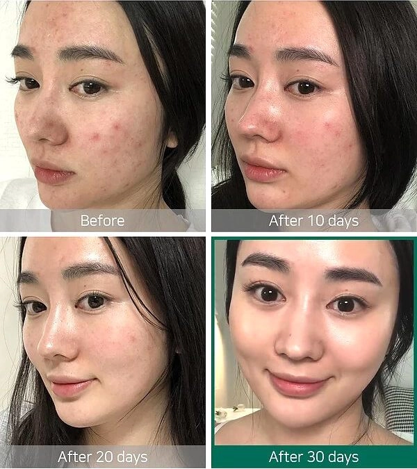 Hiểu về thành phần dưỡng trắng trị thâm để không bị dắt mũi khi mua mỹ phẩm - 2