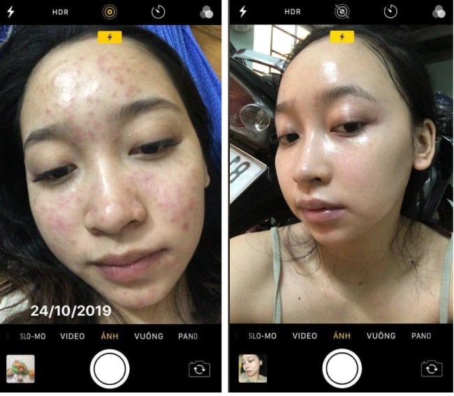 Hiểu về thành phần dưỡng trắng trị thâm để không bị dắt mũi khi mua mỹ phẩm - 7