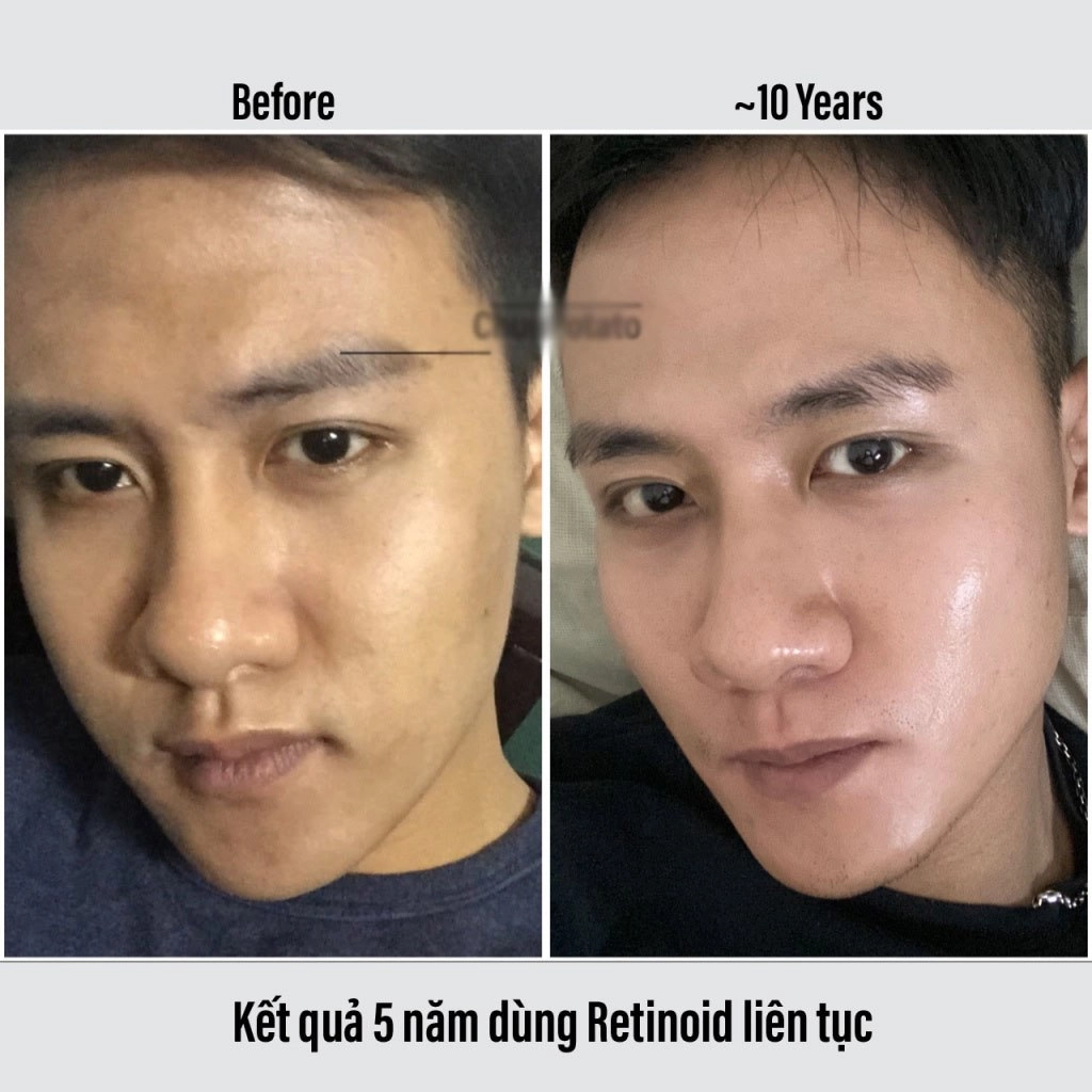 Hiểu về thành phần dưỡng trắng trị thâm để không bị dắt mũi khi mua mỹ phẩm - 8