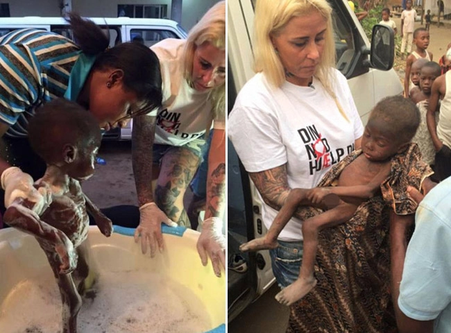 Hình ảnh béo mập sau 5 năm của em bé châu phi da bọc xương từng dậy sóng thế giới - 2