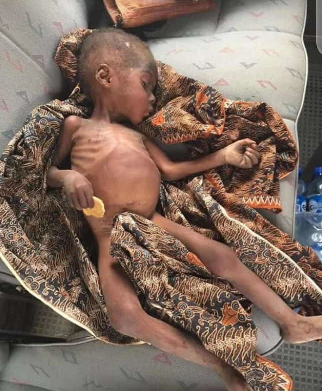 Hình ảnh béo mập sau 5 năm của em bé châu phi da bọc xương từng dậy sóng thế giới - 3