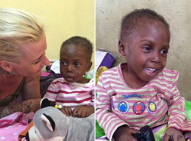 Hình ảnh béo mập sau 5 năm của em bé châu phi da bọc xương từng dậy sóng thế giới - 4