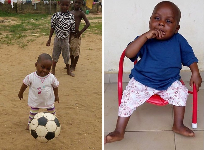 Hình ảnh béo mập sau 5 năm của em bé châu phi da bọc xương từng dậy sóng thế giới - 5