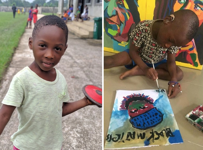 Hình ảnh béo mập sau 5 năm của em bé châu phi da bọc xương từng dậy sóng thế giới - 9