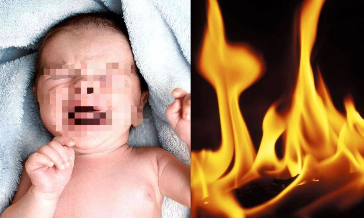 Hơ lửa quanh mặt đốt vía cho trẻ sơ sinh vừa nguy hiểm vừa tiềm ẩn nhiều hệ lụy - 2