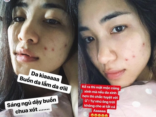 Hòa minzy mỗi lần skincare hơn 1 tiếng thanh lý cả rổ mụn nhờ chú trọng bước làm sạch - 1