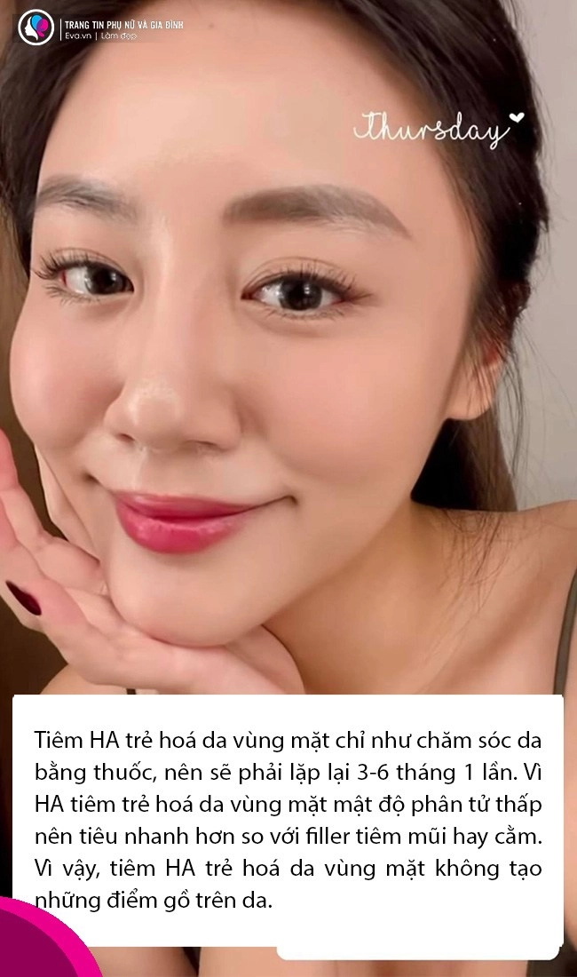 Hoá ra làn da căng bóng như gương của văn mai hương có được là nhờ tiêm ha - 7