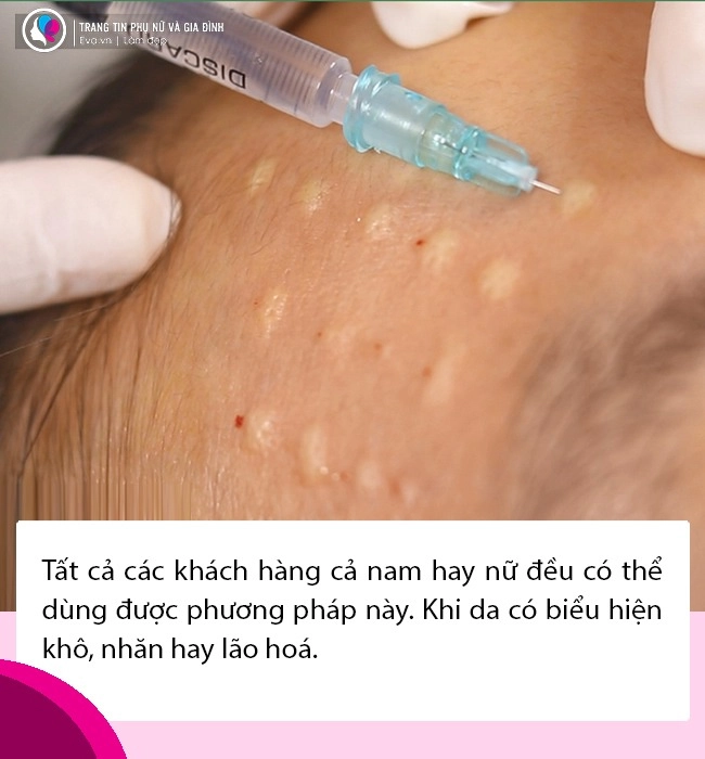 Hoá ra làn da căng bóng như gương của văn mai hương có được là nhờ tiêm ha - 8