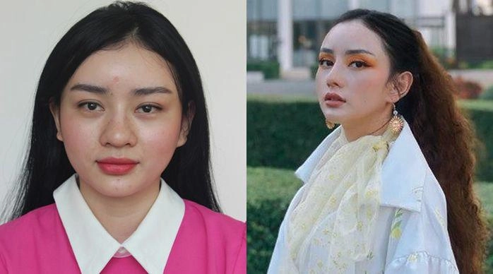 Hotgirl miền tây lấy tỷ phú thái đi nâng cơ mặt nhận về cái kết kích ứng bỏng da - 1