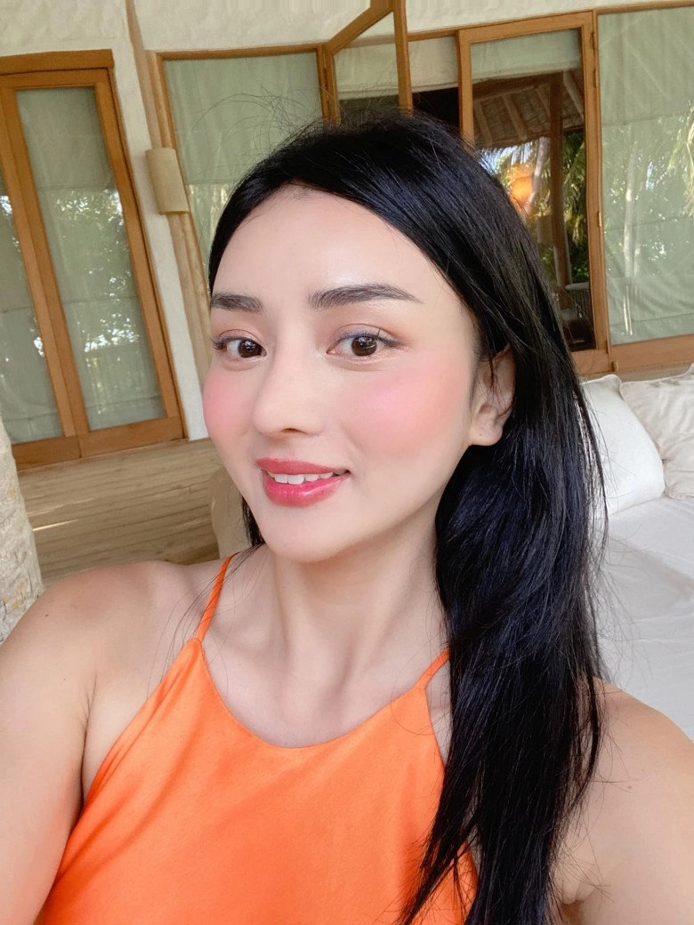 Hotgirl miền tây lấy tỷ phú thái đi nâng cơ mặt nhận về cái kết kích ứng bỏng da - 4