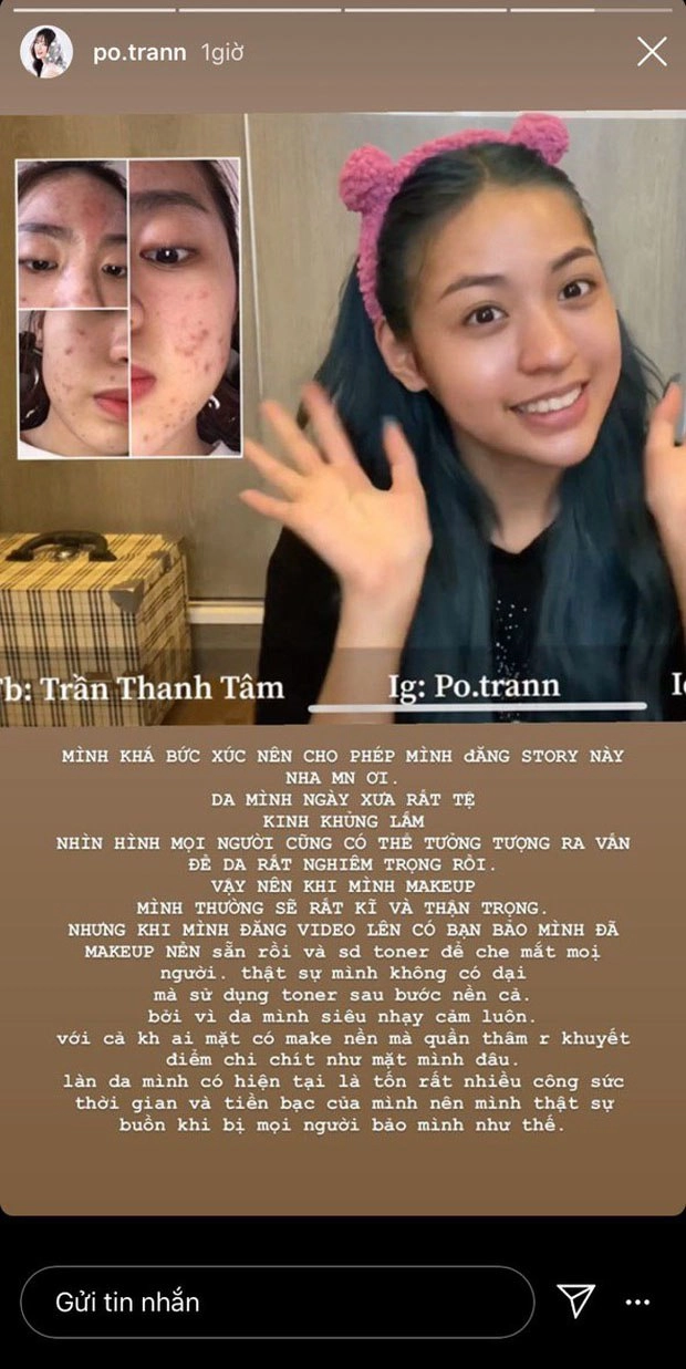 Hotgirl trứng rán cần mỡ khoe mặt mộc láng mịn nhưng lại bị dân tình tố giả dối - 6