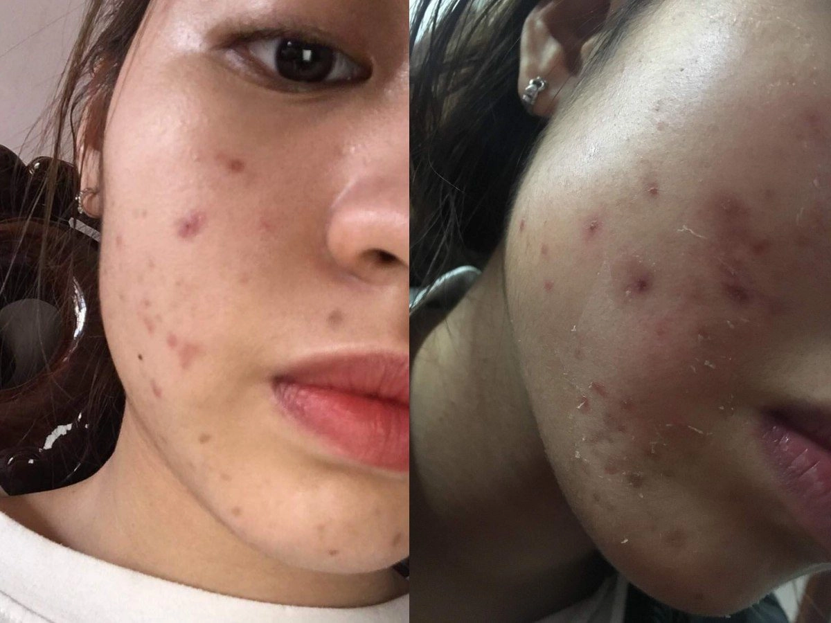 Hotgirl trứng rán cần mỡ khoe mặt mộc láng mịn nhưng lại bị dân tình tố giả dối - 7