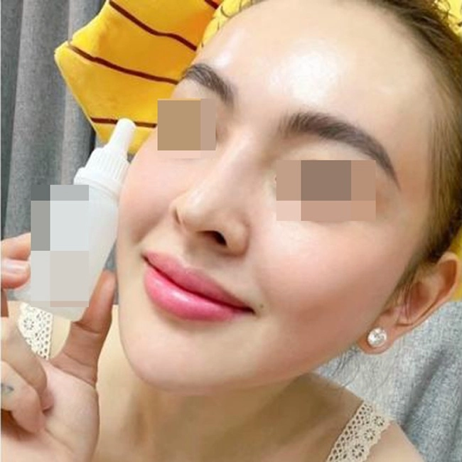 Hotgirl tự peel da tại nhà da bong mảng như rắn lột đẹp thì ít hại thì nhiều - 4