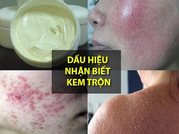 Kem trộn là gì những tác hại và cách nhận biết kem trộn trắng da - 3