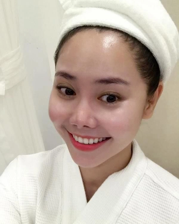 Không còn tự ti vì chiếc mũi phẫu thuật hỏng diễn viên tường vi giờ đẹp như tiên nữ - 1