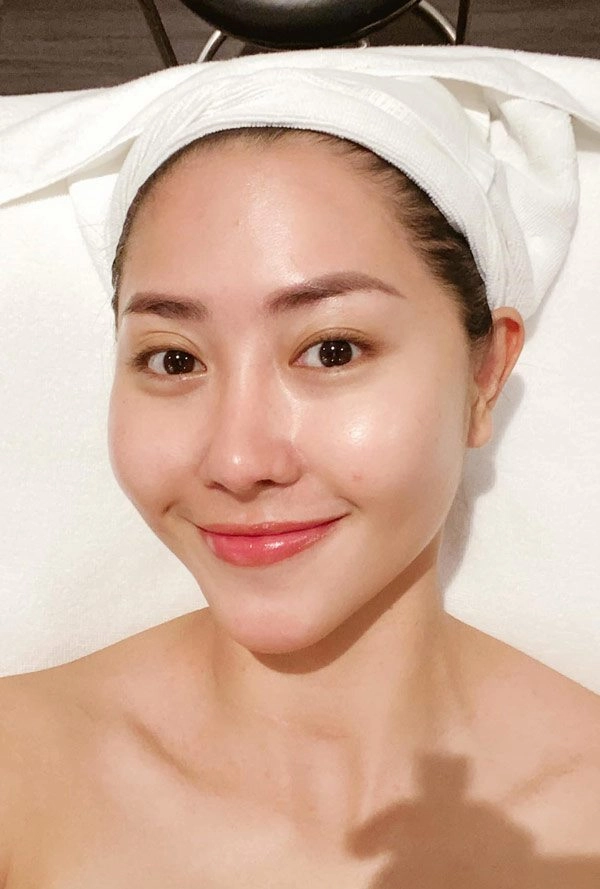 Không còn tự ti vì chiếc mũi phẫu thuật hỏng diễn viên tường vi giờ đẹp như tiên nữ - 9