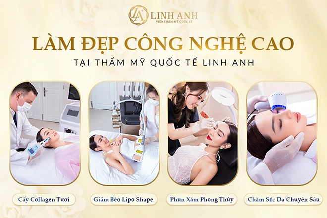 Khuyến mãi 83 siêu ngọt ngào cùng hoa hậu thùy tiên tại thẩm mỹ quốc tế linh anh - 3