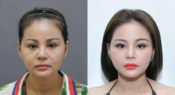 Kỷ lục dao kéo của mỹ nhân việt lê giang được cho là có đến tận 10 chiếc mũi - 1